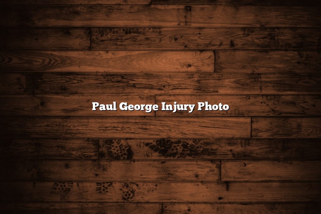 Paul George Injury Photo November 2022 Tomaswhitehouse